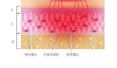 在找大型射频仪？卡酷尚美容仪-mini射频嫩肤仪把美容院搬回家